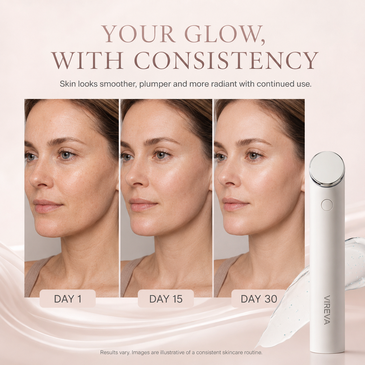 Vireva Radiance LDM Device